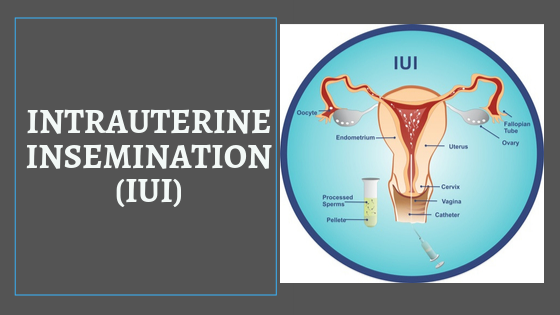 Intrauterine Insemination Brandon Fl